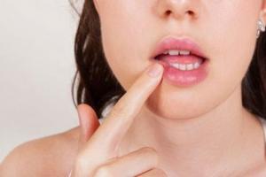 Как замаскировать герпес на губе: практические советы